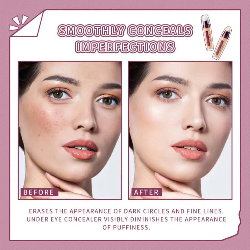 Concealer High Conceal Acne Marks Dark Circles Concealer Eraser Long-lasting Face Nursing Care Beauty Korean Women's Cosmetics